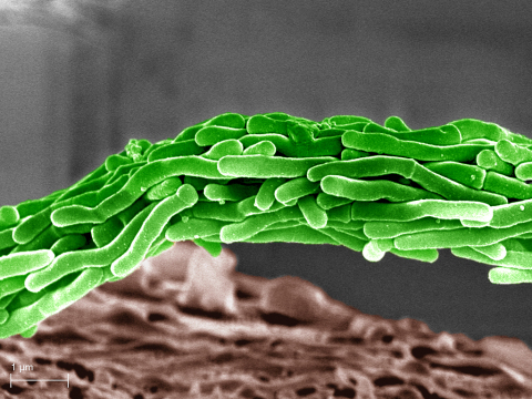 结核病菌的染色放大图（照片：美国商业资讯）