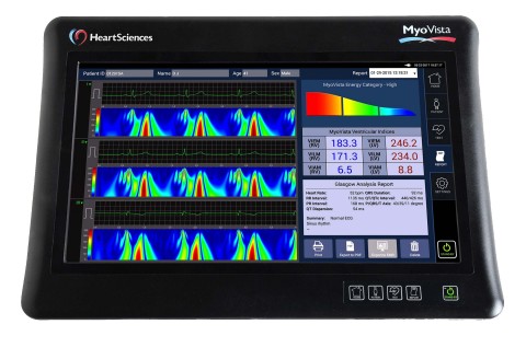HeartSciences配置信息学指标的MyoVista wavECG设备（照片：美国商业资讯） 