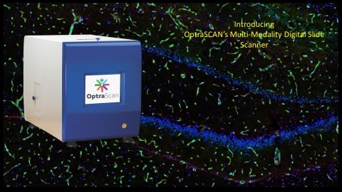OptraSCAN推出多模式数字切片扫描仪（图示：美国商业资讯） 