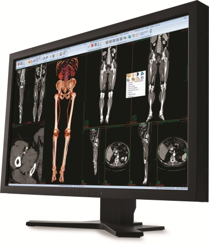 Carestream has developed strong customer relationships in attractive, high-growth healthcare segments and is positioned for continued growth and success.