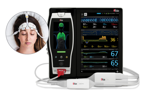 Masimo Root®搭配O3®局部氧饱和度仪和下一代SedLine®脑功能监护仪（图示：美国商业资讯） 