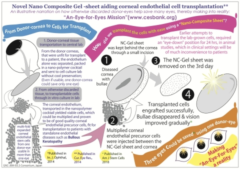 治療水疱性角膜病變的角膜內皮細胞移植法採用聚合物雞尾酒和奈米複合膠片從實驗室向臨床轉化（圖片：美國商業資訊） 