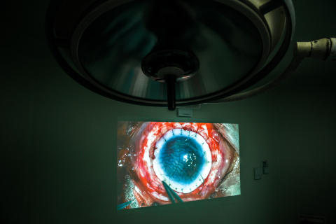 The pro-regeneration biosynthetic could eliminate the need for invasive corneal transplant surgery. (Photo: Business Wire)