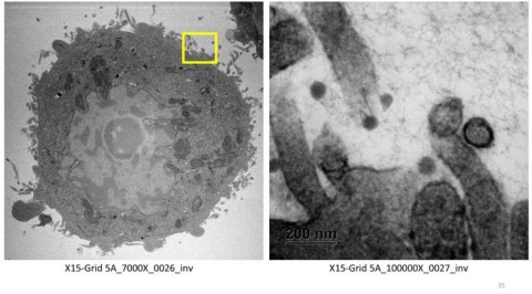 我们通过使用电子显微镜获得的视觉证据显示，木糖醇和葡萄柚籽提取物(GSE)可抵御该病毒。GSE可杀死病毒，而木糖醇可阻止病毒附着于细胞壁。该图显示，SARS-CoV-2病毒位于细胞外侧且从未附着，因此可阻止感染（照片：美国商业资讯） 