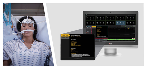 Masimo Patient SafetyNet™ with Sepsis Index (Si™) (Photo: Business Wire)