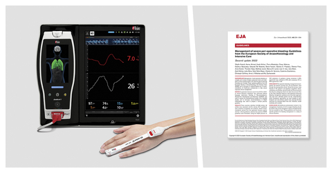 Masimo Root® with SpHb® (Graphic: Business Wire)