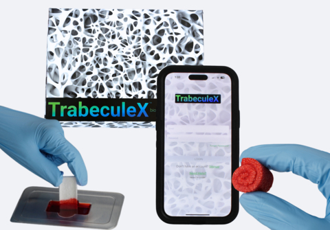 1月11日，開拓性醫療科技公司Xenco Medical在內華達州拉斯維加斯舉行的2024年消費電子展上展示了TrabeculeX Continuum™，從而揭開了連接數位健康和生物材料的融合科技的面紗。TrabeculeX Continuum包括TrabeculeX Bioactive Matrix™和TrabeculeX Recovery App™，是整形生物材料和數位健康之間的第一座由科技促成的橋樑，統一了病患的生物材料植入和術後旅程。（圖片：美國商業資訊）
