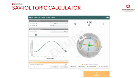 推出新功能，探索SAV-IOL Toric Calculator上獨特的切口位置優化工具。 （SAV-IOL SA圖片）