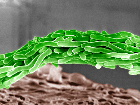 Micrographed Mycobacterium tuberculosis (Photo: Business Wire) 