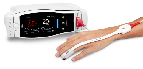 Masimo Radical-7®脈搏碳氧血氧飽和度儀®搭配rainbow SET™ PVi® (照片:美國商業資訊)