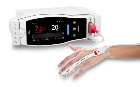 Masimo Radical-7®搭載SpHb®、PVi®和RD rainbow SET™感測器(照片:美國商業資訊)