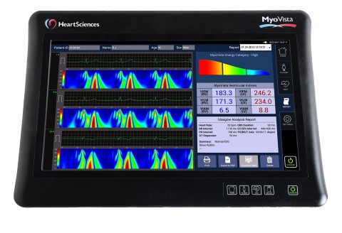 HeartSciences’ MyoVista wavECG Device with Informatics (Photo: Business Wire)