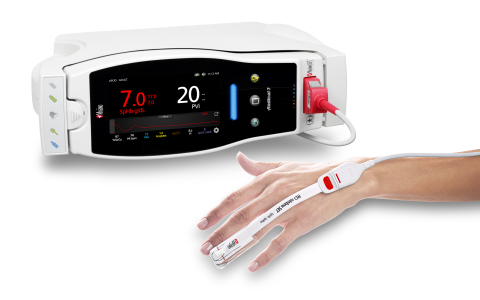 Masimo Radical-7®搭配SpHb®和RD rainbow SET™感測器(照片:美國商業資訊)