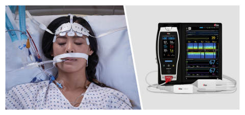 Masimo Root®搭配O3®局部氧饱和度仪和SedLine®脑功能监护（照片：美国商业资讯） 