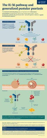 The IL-36 pathway and generalized pustular psoriasis (Graphic: Business Wire)