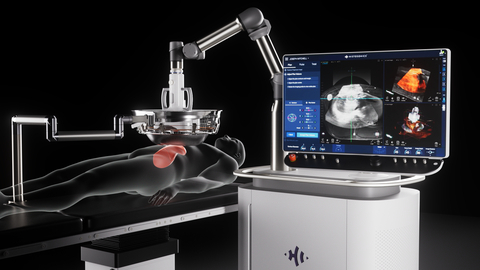 HistoSonics Edison 組織摧毀術系統 (照片：美國商業資訊) 
