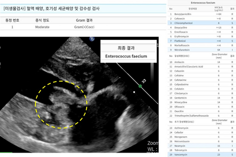 Severely degenerated mitral valve and proliferative vegetations were identified within the yellow circle. Infective endocarditis was definitively diagnosed through blood cultures and echocardiography (Photo: NEL Animal Cardiovascular Center)