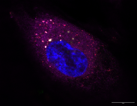 BK病毒感染的人肾上皮细胞

