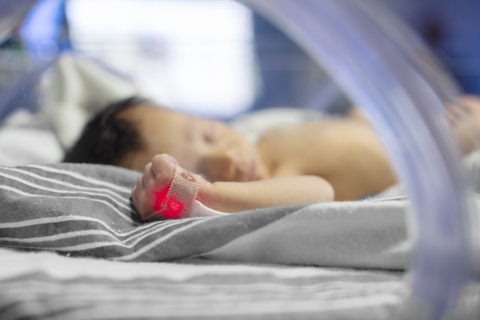 Masimo RD SET® Neo脉搏血氧仪传感器 