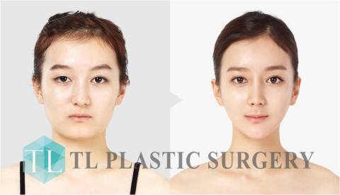 TL Plastic Surgery (Photo: Business Wire) 