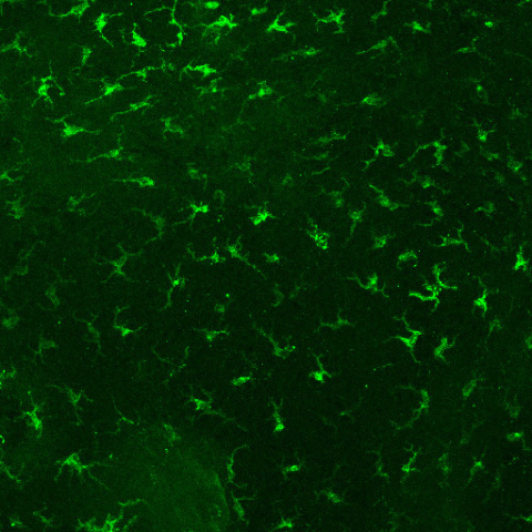 Shiseido focuses on Langerhans cells, cross-sectional view of epidermis showing the location of Langerhans cells (Photo: Business Wire) 