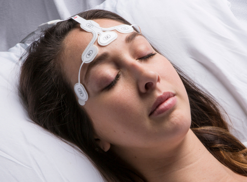 Masimo RD SedLine®成人脑电图传感器(照片:美国商业资讯)