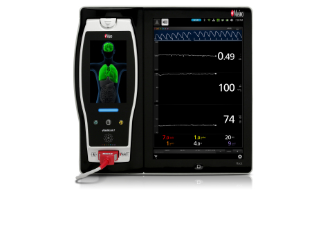 Masimo Root® 及ORI™（照片：美國商業資訊）